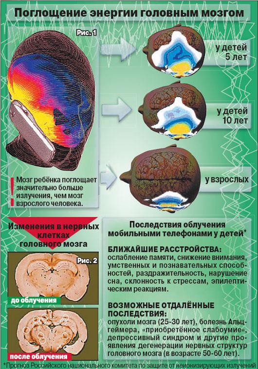 Облучение мобилным телефоном мозг